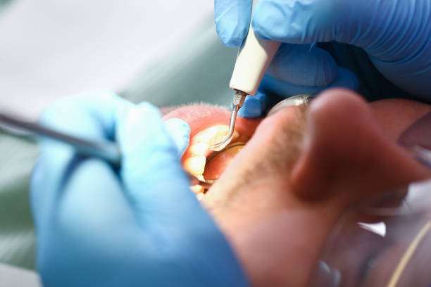 Best Mobile Emergency Dentist in St Charles, MO