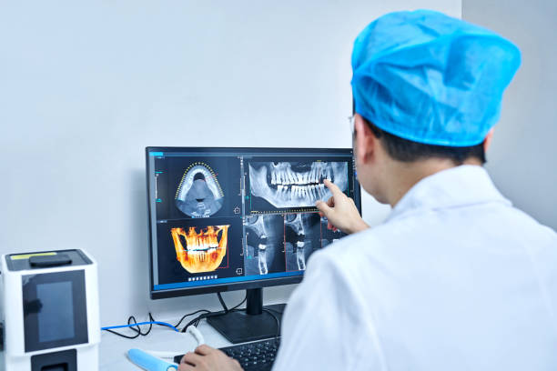 Best Emergency Dentist for Lost Fillings or Crowns in St Charles, MO